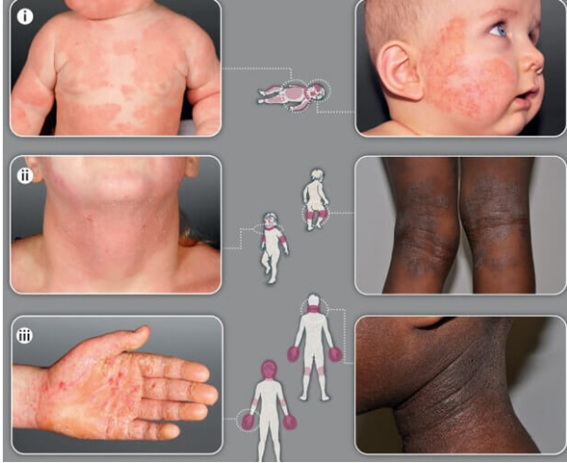 A Importância da Super-observação com Novos Alimentos - inspiração 2