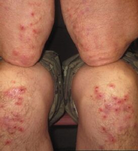 Opções de Lanches e Refeições Deliciosas e Seguras - inspiração 1