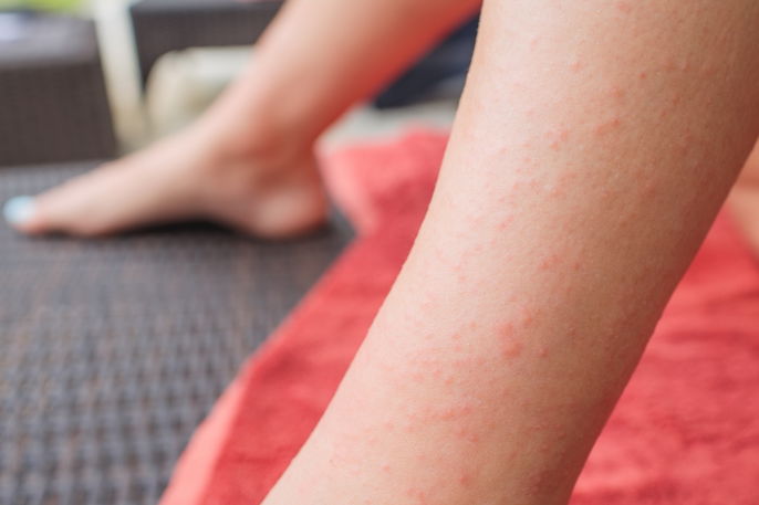 Opções de Lanches e Refeições Deliciosas e Seguras - inspiração 2