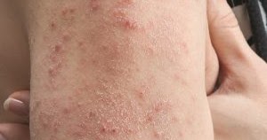 Lidando com a Ansiedade e o Estresse Relacionados à Dieta - inspiração 1