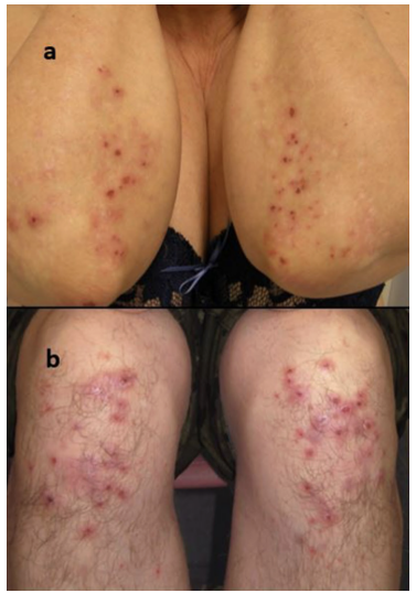 Lidando com a Ansiedade e o Estresse Relacionados à Dieta - inspiração 2