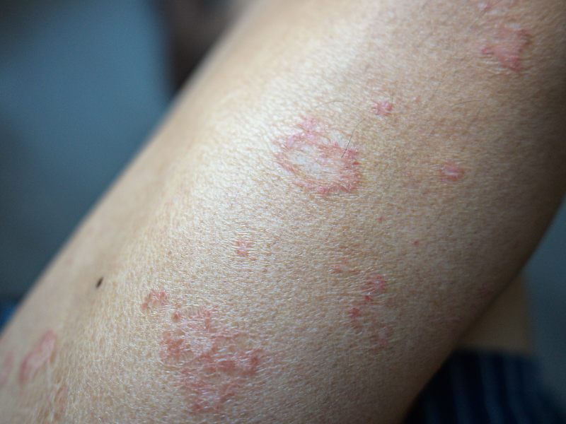 H3 A Limpeza Gentil que Sua Pele Precisa - inspiração 1