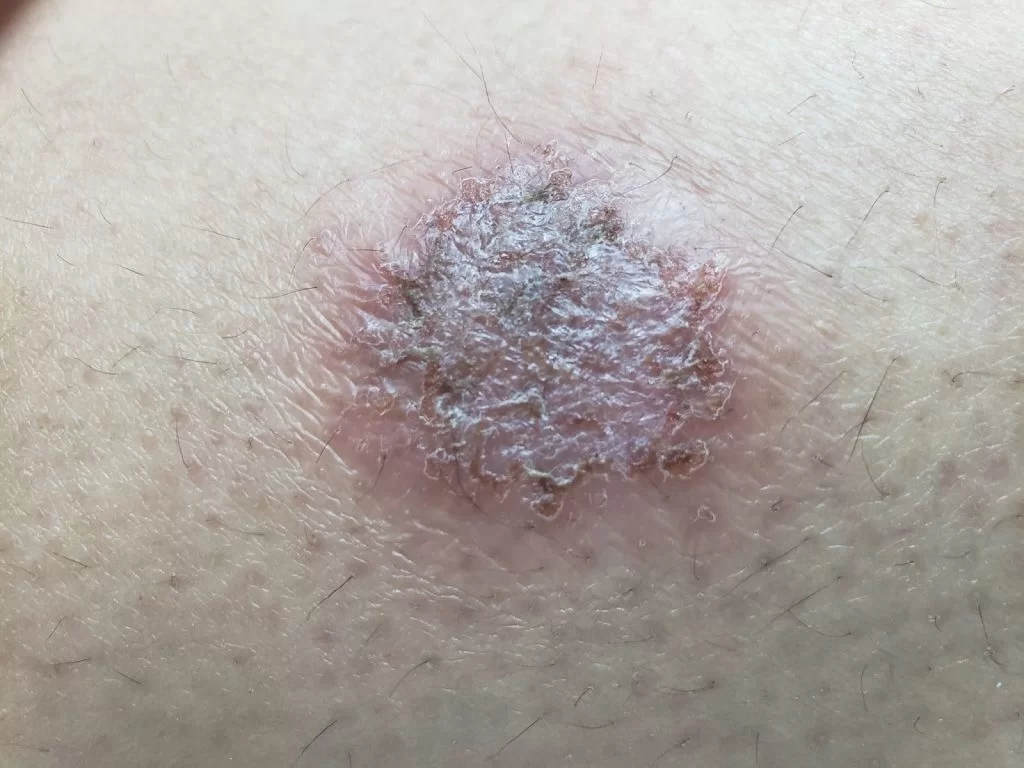 H3 Hidratação Intensiva: O Segredo para Reparar a Barreira Cutânea - inspiração 2