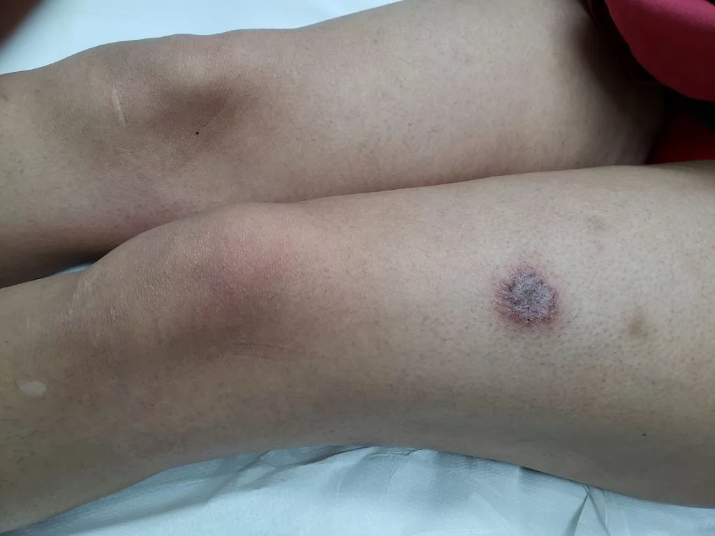 H3 A Importância da Proteção Contra Irritantes Comuns - inspiração 2