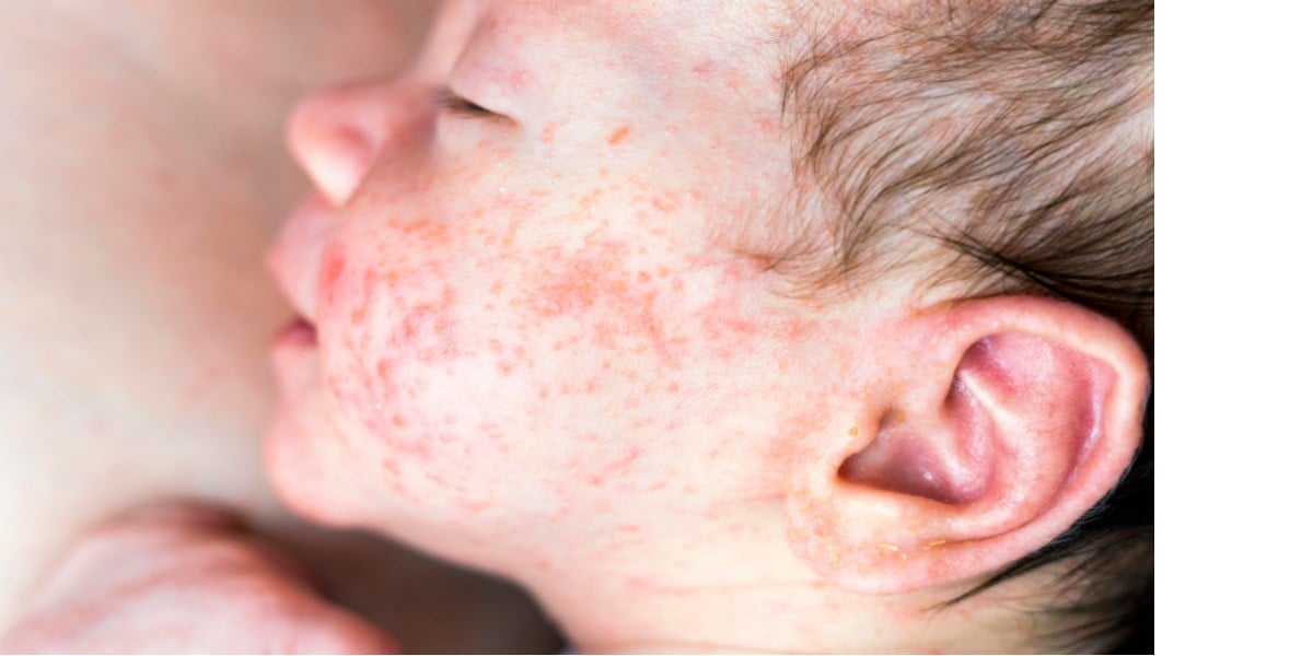 Escolhendo os Produtos Ideais: Shampoos e Sabonetes Suaves - inspiração 2