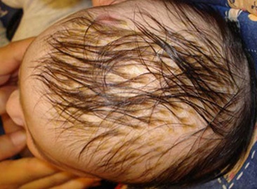 Quando Procurar o Pediatra: Sinais de Alerta e Orientações Médicas - inspiração 2