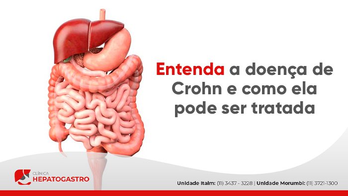 Hidratação é Chave: Beba Água Sem Distração - inspiração 1
