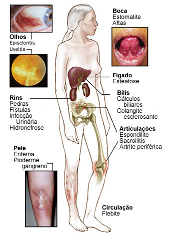 Gerenciando o Estresse: Técnicas Que Acalmam a Mente - inspiração 2