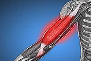 Alimentação Inteligente para Recuperação Muscular - inspiração 1