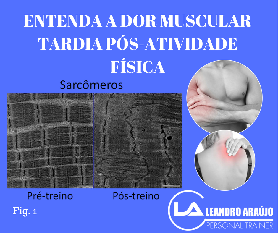 Movimento Leve para Acelerar a Cura - inspiração 2