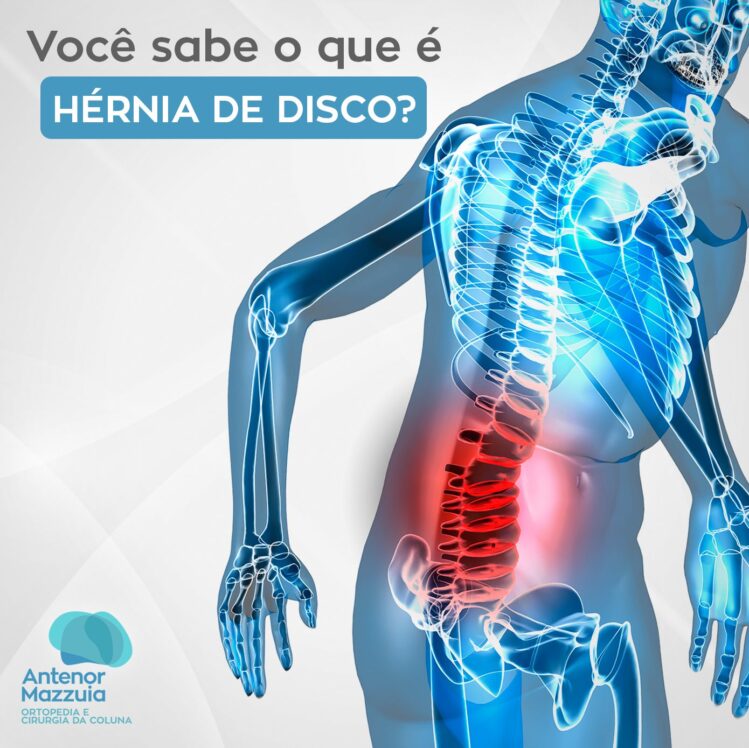 Mudanças no Estilo de Vida: Alimentação e Hidratação - inspiração 1