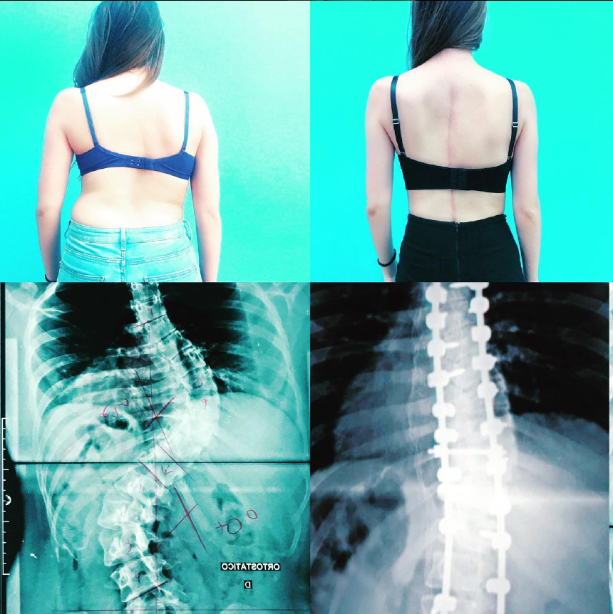 Mudanças no Estilo de Vida: Alimentação e Hidratação - inspiração 2