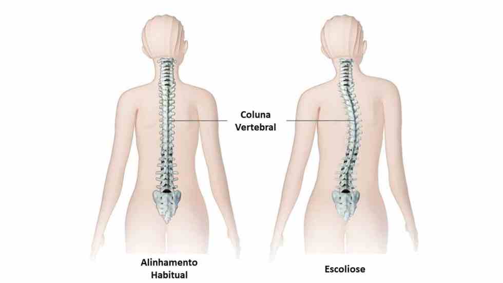Movimento é Vida: Exercícios Terapêuticos Adaptados - inspiração 1