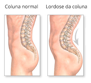 Movimentar-se é o primeiro passo: Exercícios de baixo impacto que você pode fazer hoje - inspiração 2