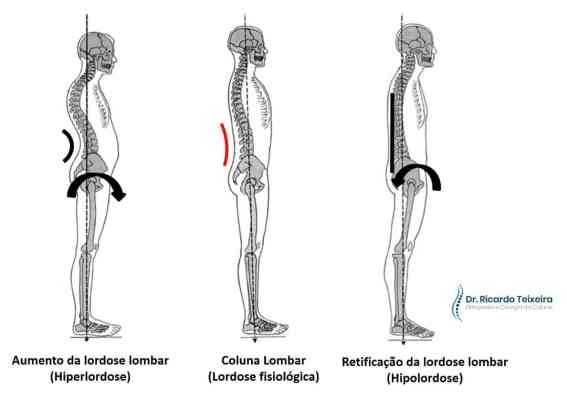 Fortalecendo o core: A base para uma coluna mais saudável - inspiração 2
