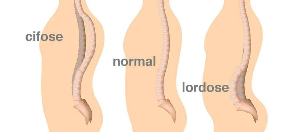 Conheça seu corpo: Identificando os gatilhos da sua dor - inspiração 2