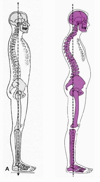 O que evitar: Movimentos e hábitos que pioram a lordose - inspiração 1