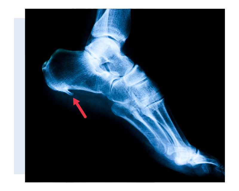 Quando Procurar Ajuda Profissional: Sinais de Que É Hora de Consultar um Médico - inspiração 2