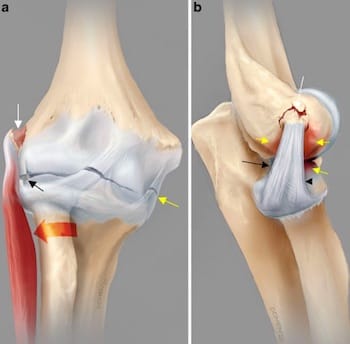 Prevenção é a chave: como evitar que a dor volte - inspiração 1