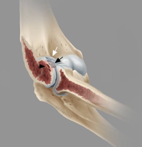 Sinais de alerta: quando a dor não é só um incômodo passageiro - inspiração 2