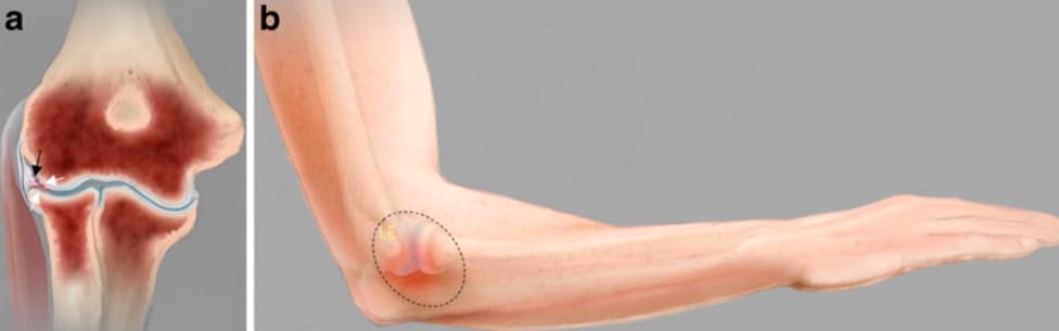 Repouso estratégico: a importância de dar um tempo para o seu braço - inspiração 1