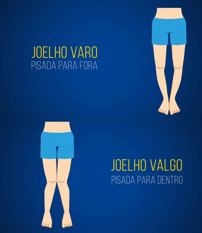 Os vilões da sua corrida: postura e técnica erradas - inspiração 2