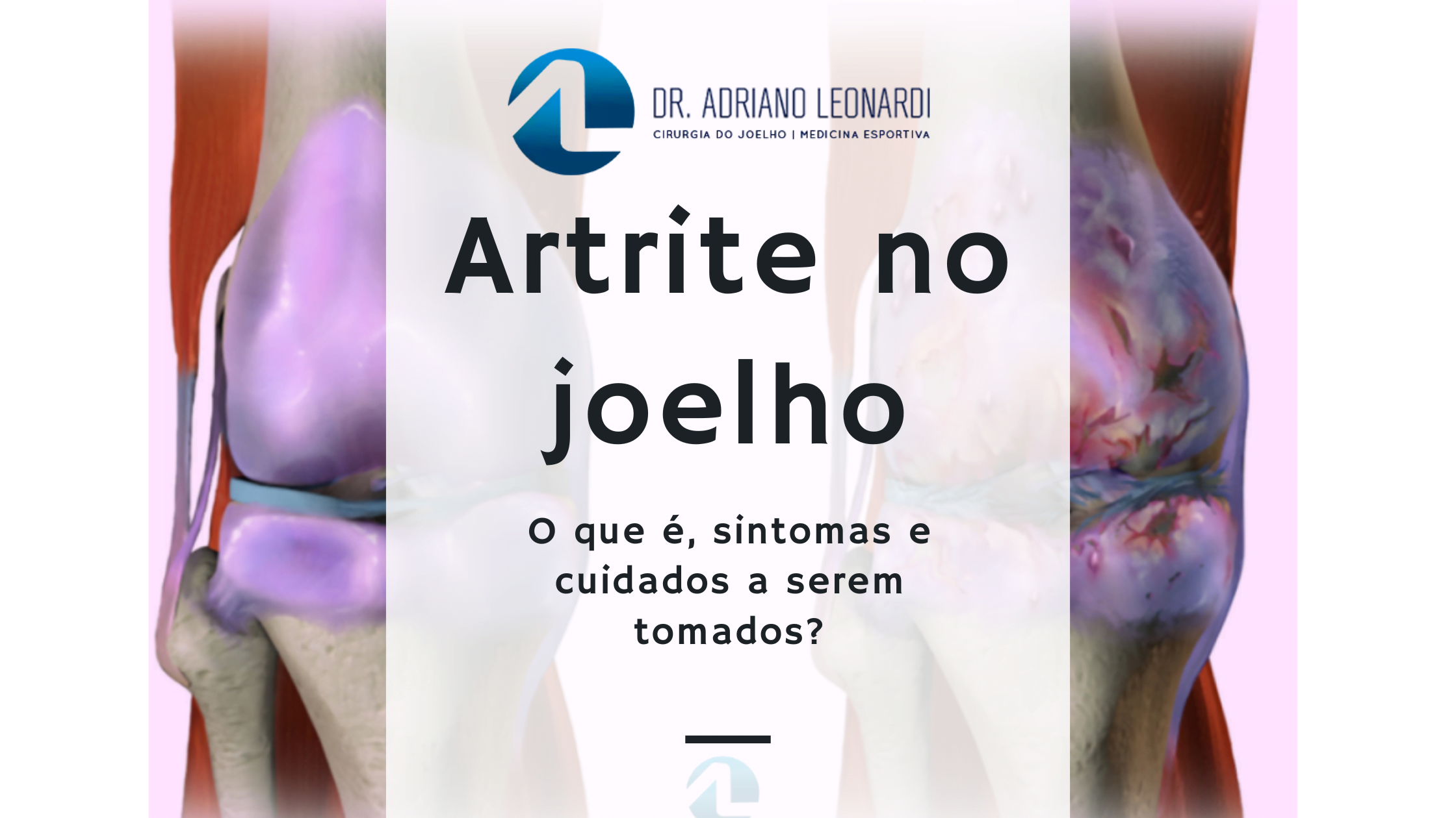 Movimento é Vida: Exercícios Gentis que Fortalecem Seus Joelhos - inspiração 2