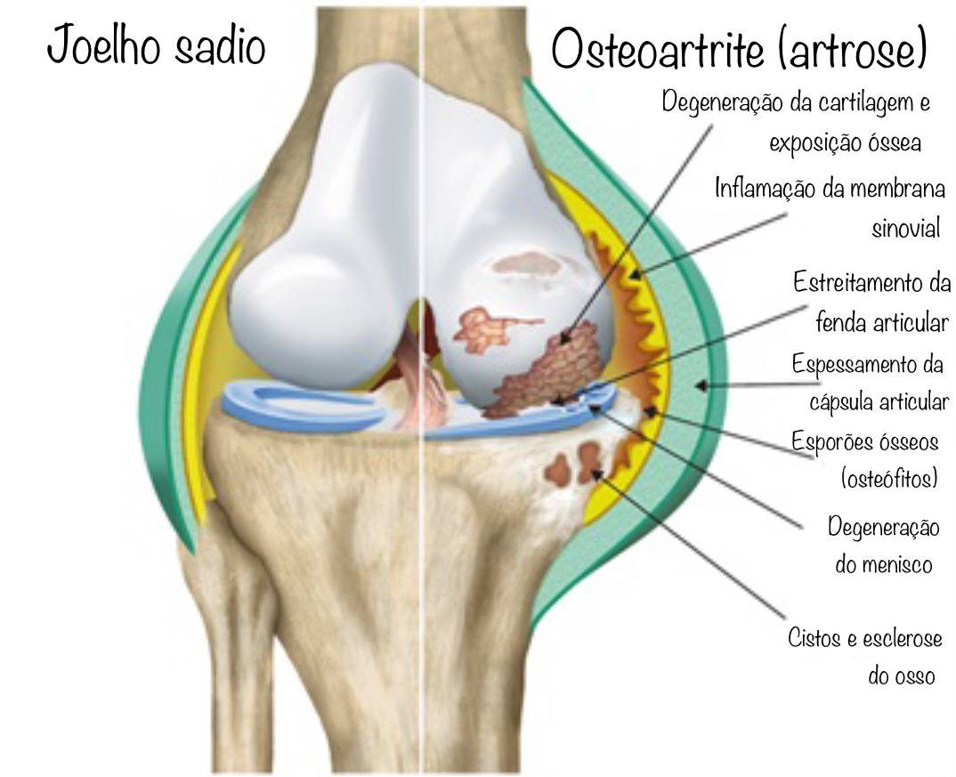 Controle da Dor: Opções Terapêuticas Que Funcionam - inspiração 1