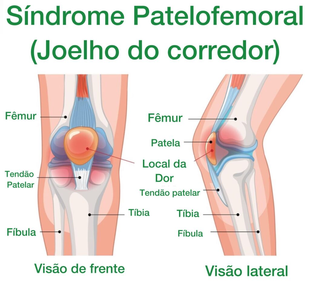 Gerenciamento da Dor: Opções e Cuidados - inspiração 2
