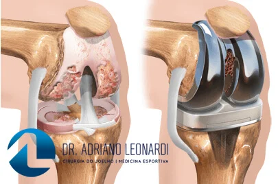 Quando Buscar Ajuda Profissional é Fundamental - inspiração 2