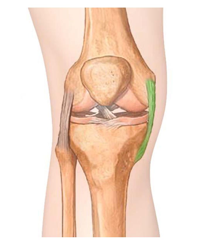 Compressão Correta: A Importância de Uma Boa Faixa - inspiração 2