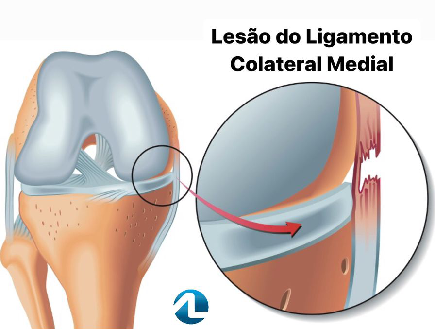 Exercícios Leves: Movimentando Sem Agredir - inspiração 1