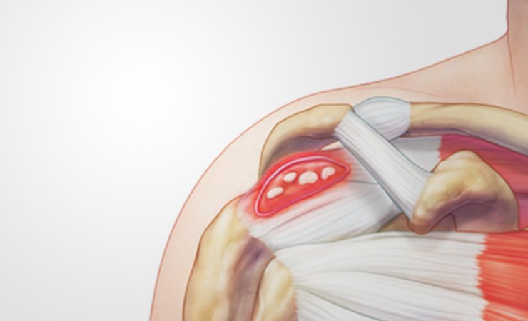 Sintomas Que Não Devem Ser Ignorados - inspiração 1