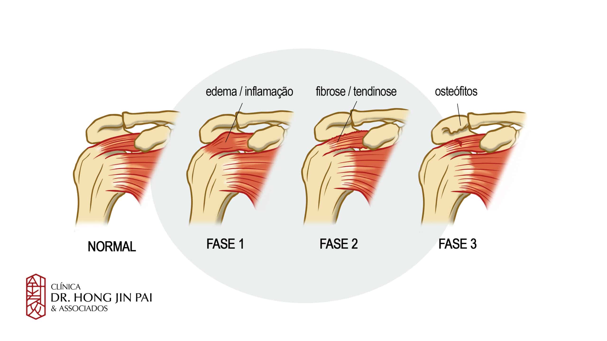 Tratamentos Conservadores: O Que Funciona de Verdade? - inspiração 2