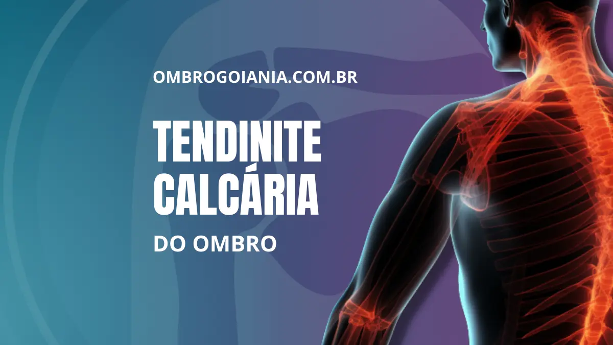 A Fisioterapia Como Aliada Essencial - inspiração 2