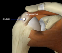 Quando a Cirurgia se Torna Necessária? - inspiração 1