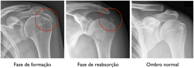 Quando a Cirurgia se Torna Necessária? - inspiração 2