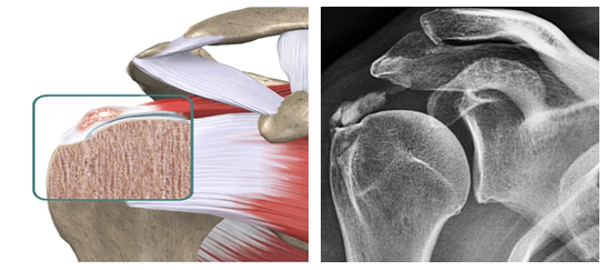 Mitos e Verdades Sobre a Recuperação - inspiração 1