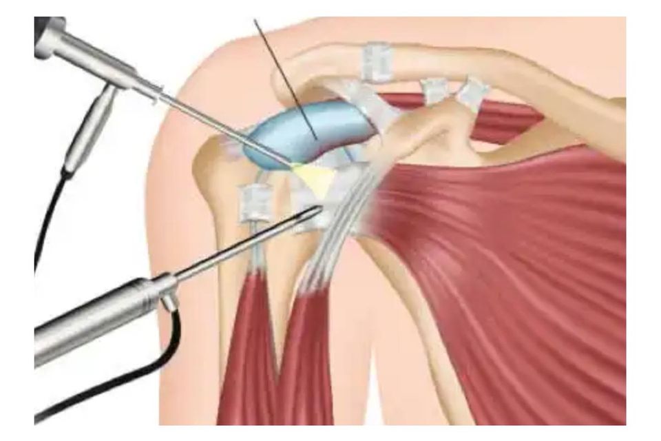 Mitos e Verdades Sobre a Recuperação - inspiração 2