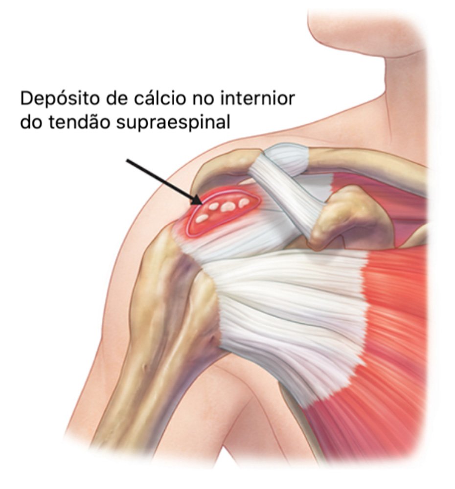 Fortalecendo Seus Músculos: Exercícios Essenciais Para a Estabilidade - inspiração 2