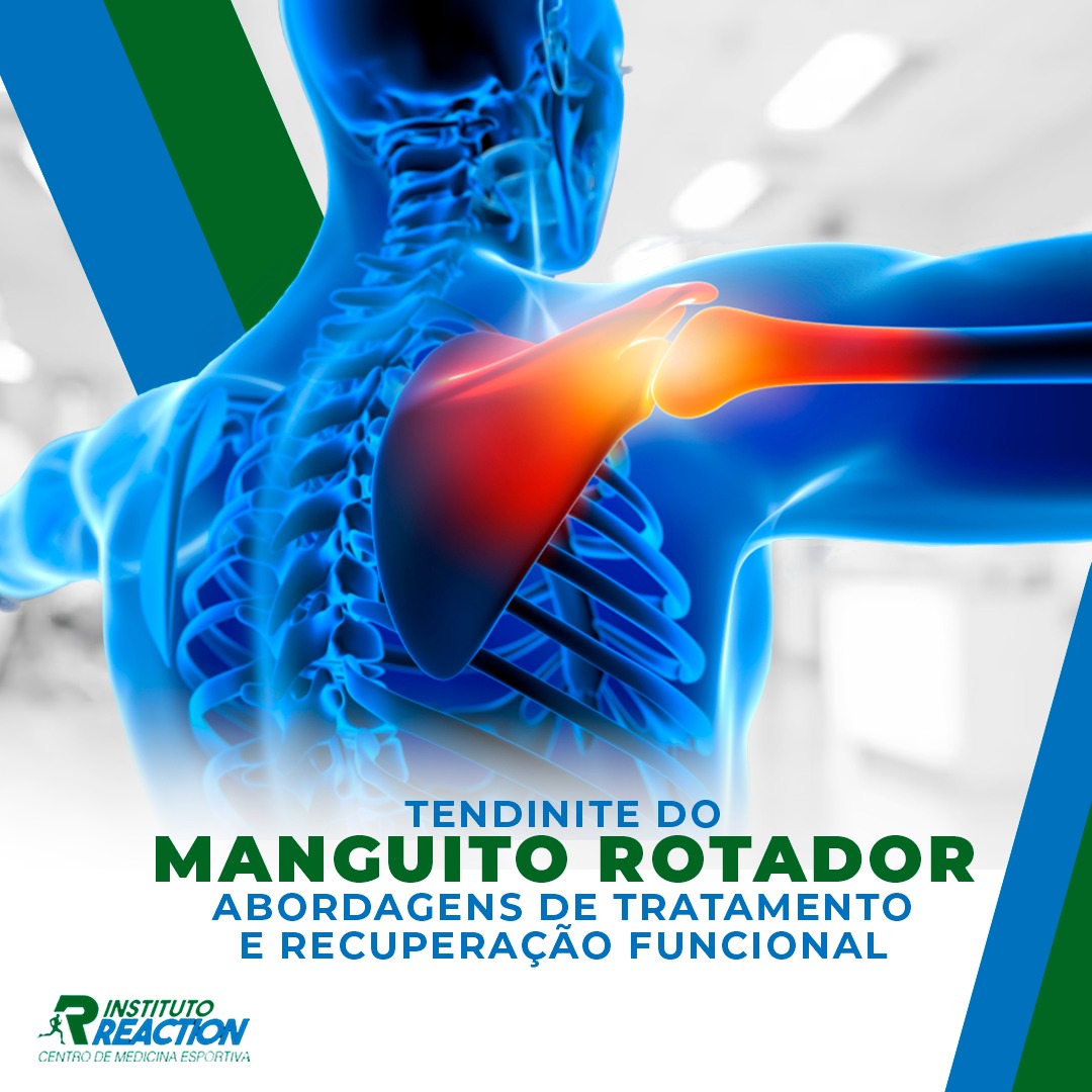 Ergonomia no Trabalho e em Casa: Adaptando Seu Ambiente - inspiração 2