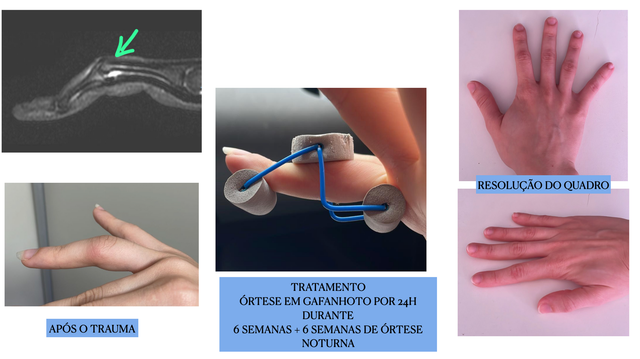 Ajuste Sua Postura: Pequenas Mudanças Fazem Grande Diferença - inspiração 2