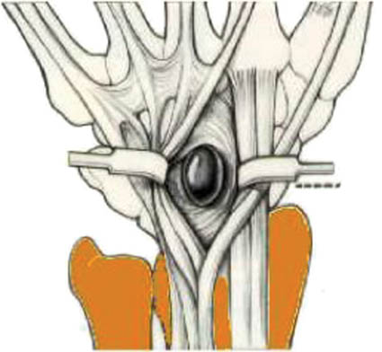Fatores de risco: o que pode desencadear? - inspiração 1