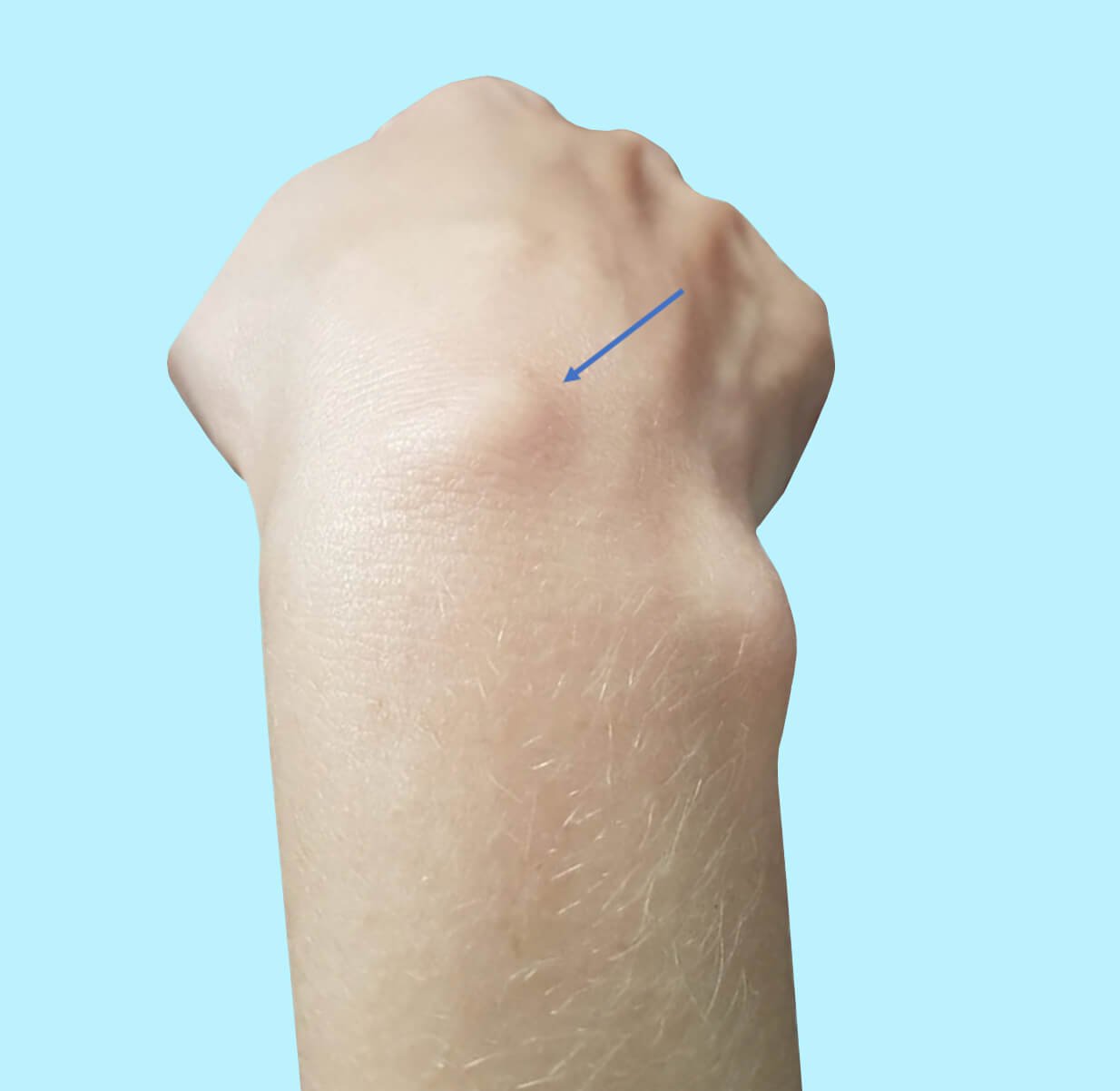 Fatores de risco: o que pode desencadear? - inspiração 2