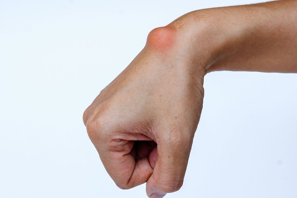 Por que ele aparece no meu pulso? - inspiração 1