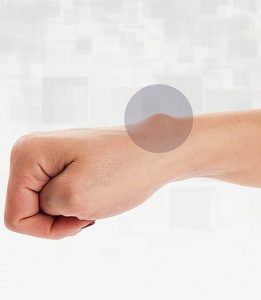 Diferenciando de outras dores no pulso. - inspiração 2