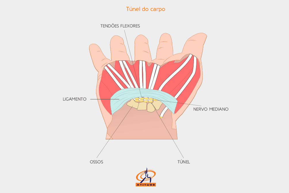 Calor ou Frio? Quando Usar Cada Um Para Alívio - inspiração 2