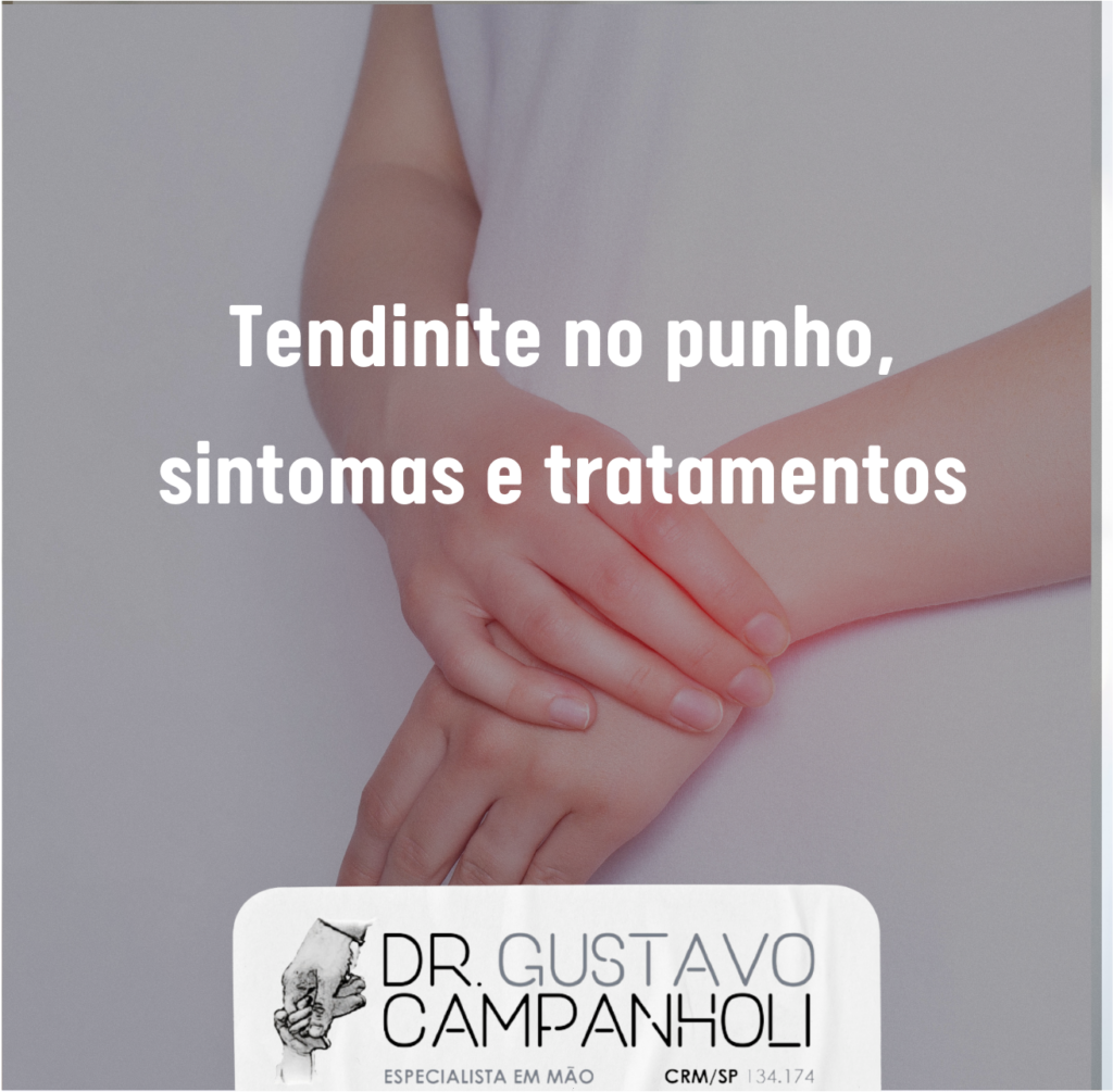 Os primeiros sinais que seu corpo te dá: fique atenta! - inspiração 1