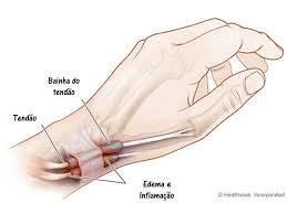 Ergonomia: Ajustando seu dia a dia para evitar sobrecarga - inspiração 2