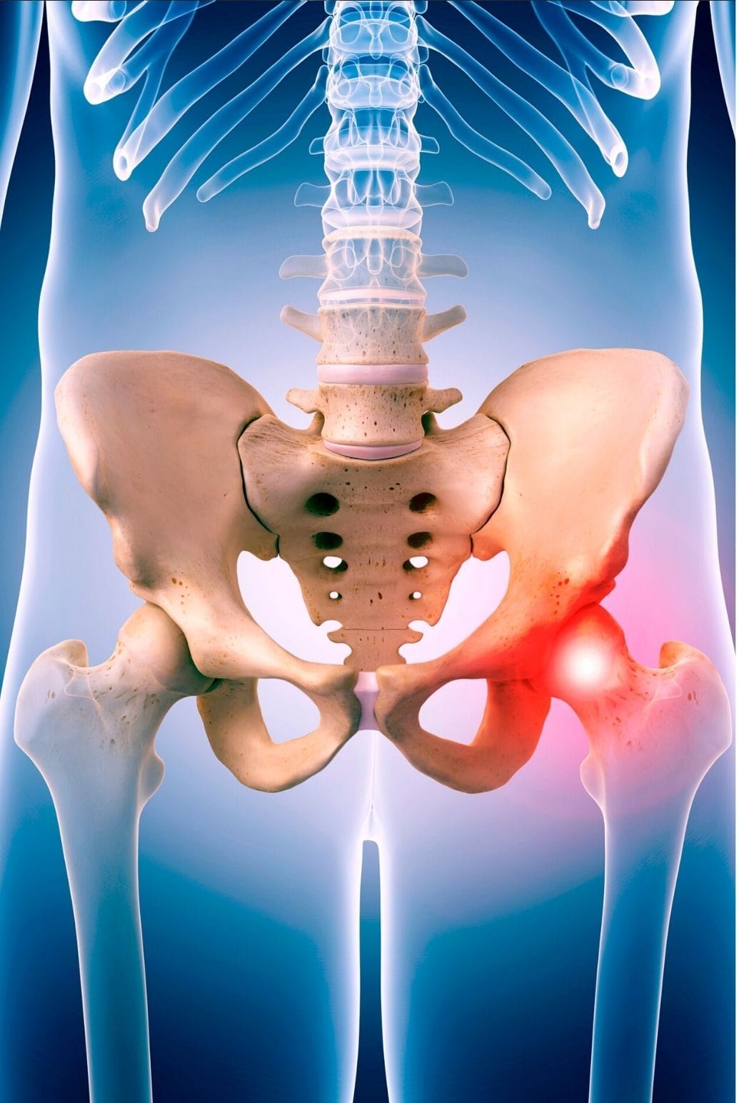 Atenção à Postura: Como Seus Movimentos Afetam o Quadril - inspiração 2